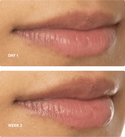 بيبتيد لب بوست من رود