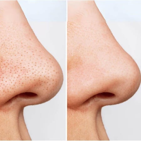 انوا غسول زيتي هارتليف للتحكم في المسام - 200 مل