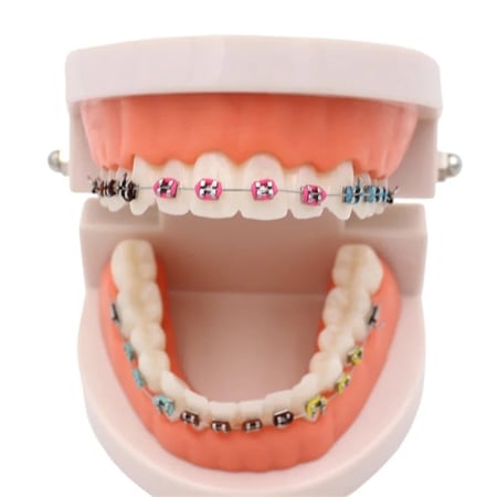 نموذج تقويم اسنان