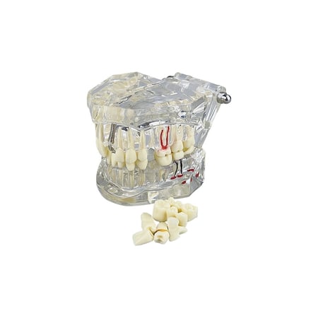 نموذج امراض الأسنان