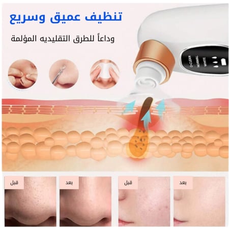 جهاز تنظيف الوجه الكهربائي 4 في 1