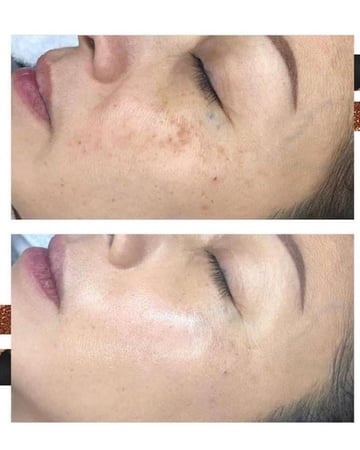 سيليكون عضوي لشد وتحسين مرونة البشرة واغلاق المسامات ومكافحة الترهلات