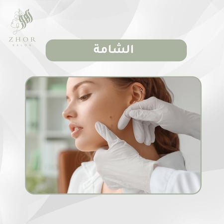 شامة