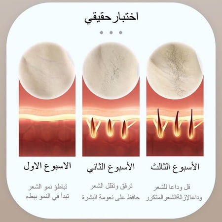 ليزر ملاي T14 عدسة وحدة