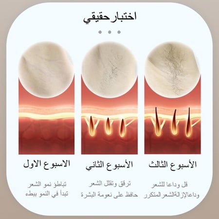 ليزر ملاي T14 بخاصية التبريد و3 عسات (احدث جهاز ملاي)
