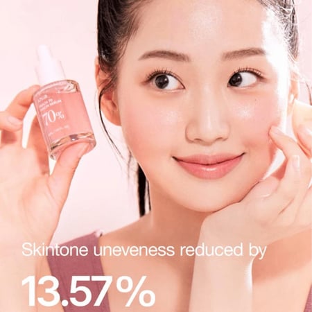 انوا سيروم النياسيناميد %70 من الخوخ 30 مل