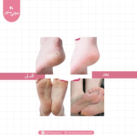 قفازات وجوارب الساونا