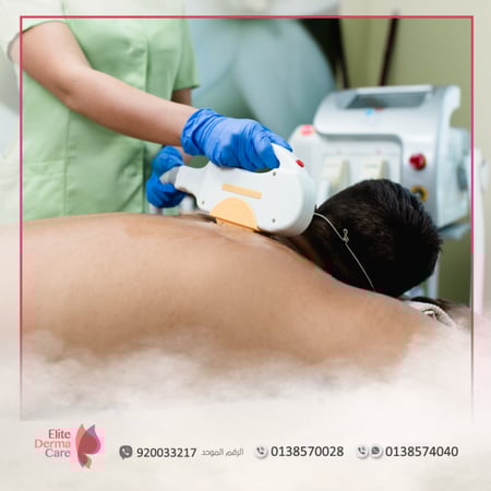 ليزر الظهر كاملة -  متجر عيادات الدكتورة ليلى العنيزي الطبي - الخبر