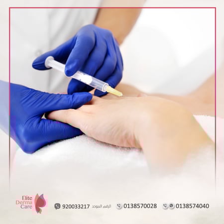 فيلر - متجر عيادات الدكتورة ليلى العنيزي الطبي - الخبر