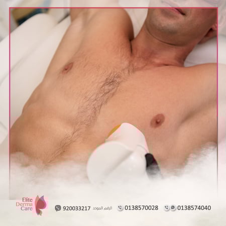 ليزر الجزء العلوى - متجر عيادات الدكتورة ليلى العنيزي الطبي - الخبر