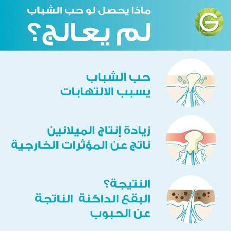 جارنييه سيروم مقاوم للحبوب للبشرة المعرضة لحب الشباب 15 مل