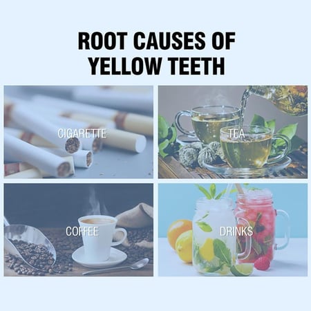 بودرة تبييض الاسنان للمدخنين بنكهة الليمون من ديسار- 50 جم