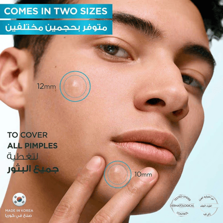 استخدام غارنييه لصقات غير المرئية لعلاج البثور على الوجه