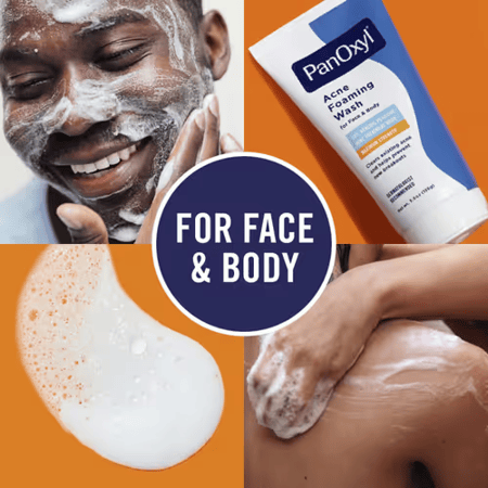 استخدام غسول كريمي لحب الشباب بنزويل بيروكسيد 4 من بانوكسيل - 170ج