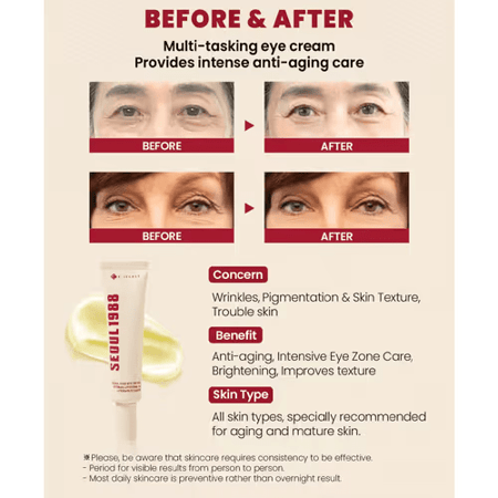 كي سيكرت سيول 1988 كريم عيون ريتينال 30مل مقارنة قبل وبعد الاستخدام