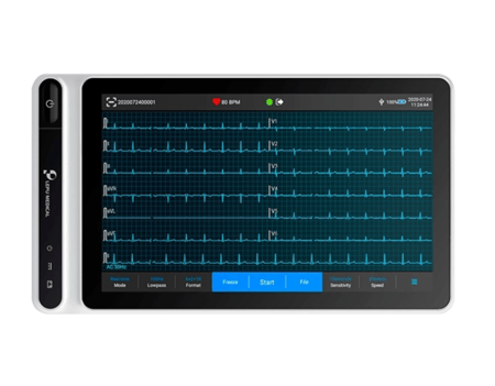 جهاز تخطيط القلب محمول NeoECG S120