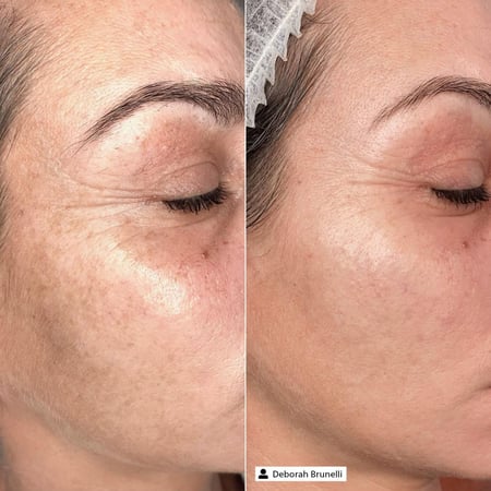 Derma SR Rich Firming Cream -Day With UV