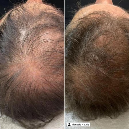 Derma SR Hair Vitalizer Essence