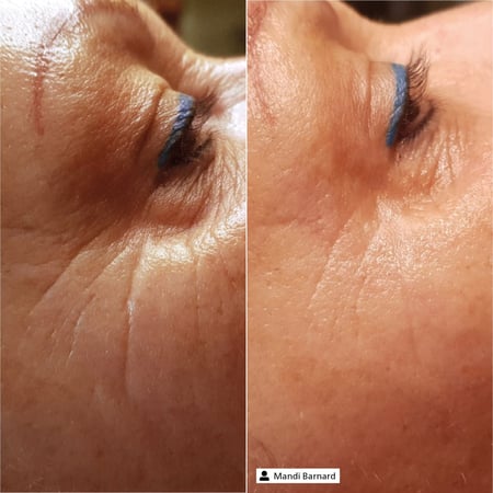 Derma SR Eye Expert Serum