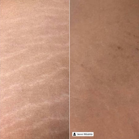 Derma SR Tissue Firming Serum