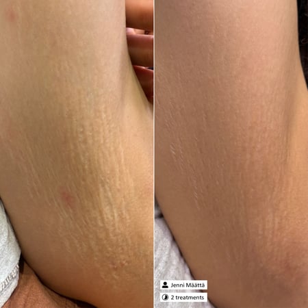Derma SR Active Exosome Serum