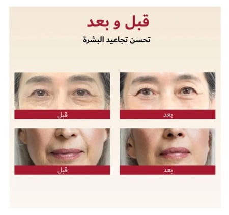 كريم سيول 1988 المجدد من كي سيكريت بالريتينال الليبوسومي والأرز المخمّر