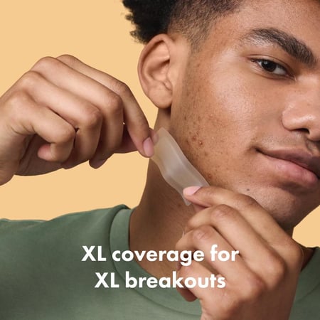 لصقة حب الشباب والبثور