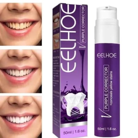 جل تبييض الأسنان EELHOE