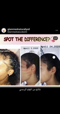 زيت التألق لتحفيز وتطويل الشعر  والقضاء ع الفراغات حجم 118  مل 4 اونصه من  غلامد ناتشورالي اويل  glammednaturallyoil