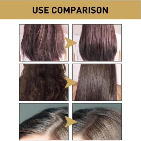 شامبو ساكورا الياباني لنمو الشعر ومنع تساقط الشعر وازالة القشرة 300 مل