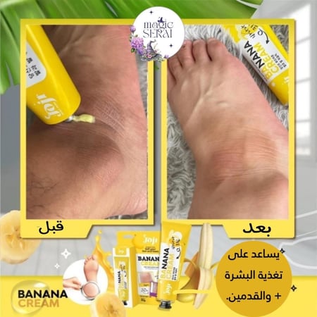 كريم جوجي سيكريت يونج سوفت بالموز للعناية بالقدمين
