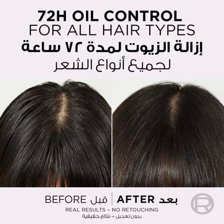 لوريال باريس الفيف هيالورون بيور شامبو منقي فروة الرأس ومرطب للشعر 400 مل