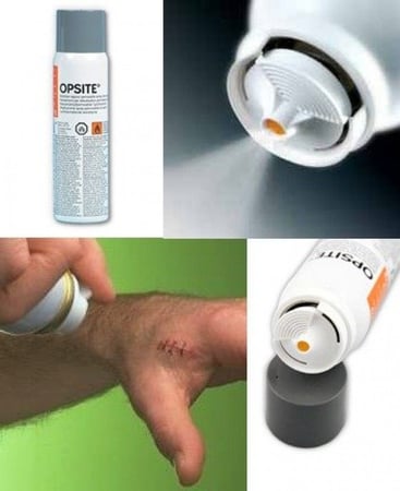 بخاخ لحماية الجروح الجراحية البسيطة و الخدوش والجروح الجافة - 240 مل من اوبسيت - OPSITE Wound Spray