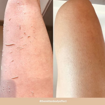 قفازين تقشير glowy skin
