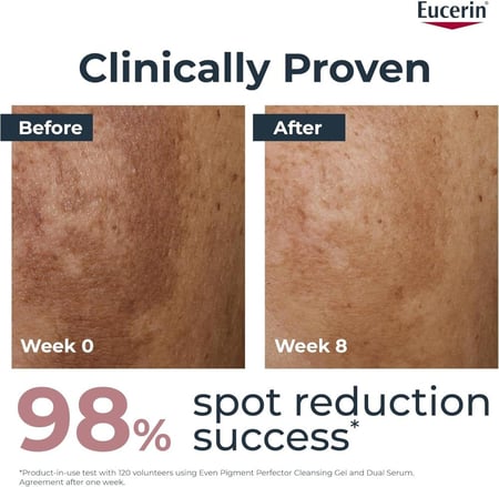 سيروم يوسيرين المزدوج  مضاد للتصيغ 30 مل