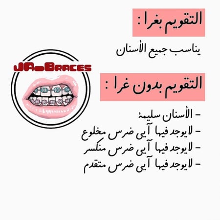 تقويم اسنان زينة (بكج) فك بدون غرا متصل " شامل الشحن "