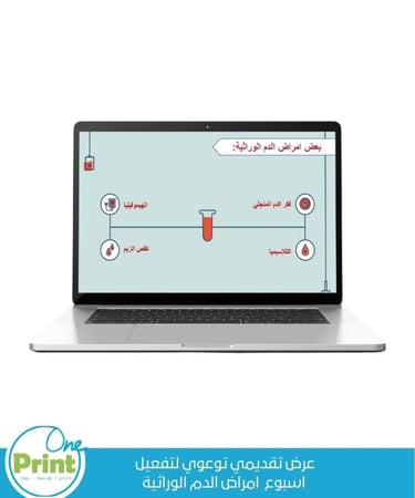 عرض تقديمي توعوي لتفعيل اسبوع  امراض الدم الوراثية