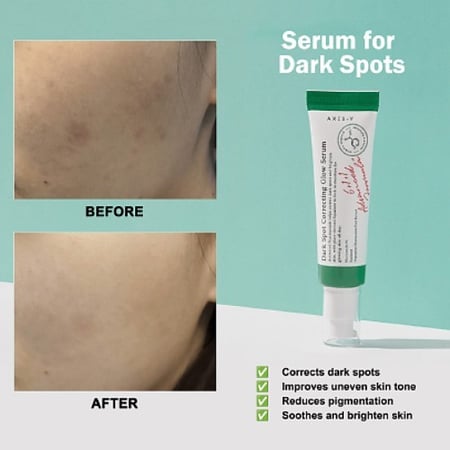 AXIS -Y Dark Spot Correcting Glow Serum سيروم لتخفيف التصبغات
