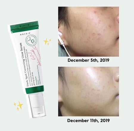 AXIS -Y Dark Spot Correcting Glow Serum سيروم لتخفيف التصبغات