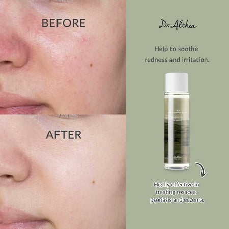 Dr. Althea Cica Skin Calming Toner -  تونر لتهدئة البشره و تحسين الحاجز من دكتور اليثيا