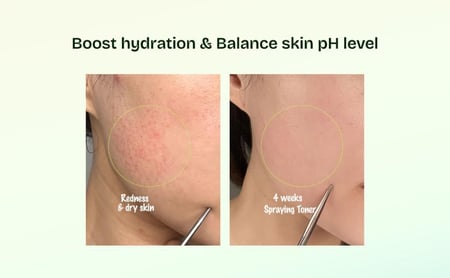 ORIEN MUGWORT SOOTHE IN TONER 160ML وداعاً للاحمرار.. امنحي بشرتك الهدوء الذي تحتاجه مع تونر أورين موغورت.