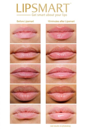 ليبسمارت مرطب