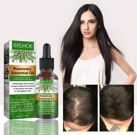 زيت مركز الروز ماري(اكليل الجبل )لانبات الشعر وتغذية فروة الرأس  اخفاء الشعر الابيض تدريجيا