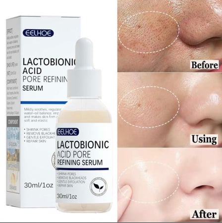 سيروم حمض الاكتبونيك يقلص المسامات وينظف الرؤوس السوداء يمنع حب الشباب يجدد خلايا البشرة  يقلل من ظهرور التجاعيد والخطوط الدقيقة