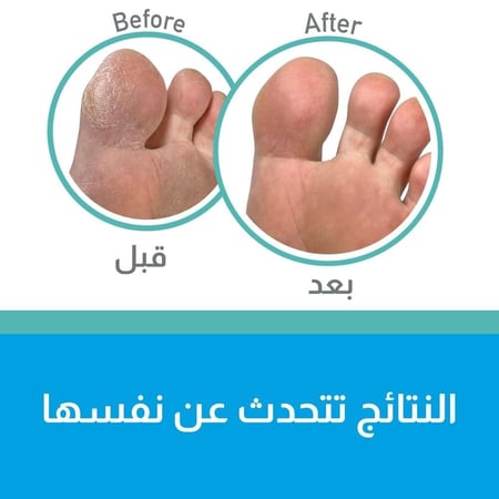 اوكفيز  ماسك للقدمين مرطب - 2قطعة