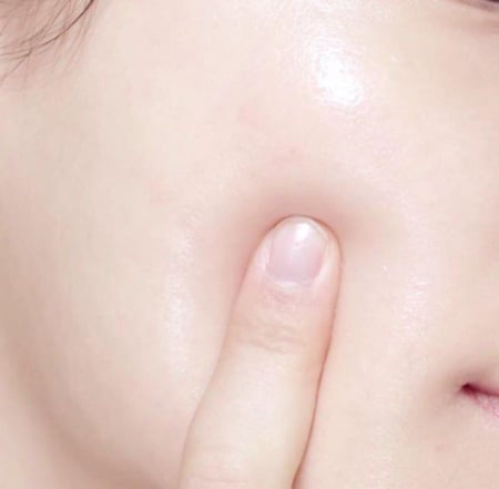 اكسيس واي سيروم لتصحيح البقع الداكنة وتفتيح البشرة - 50مل