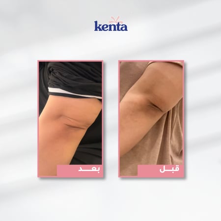 مجموعة كينتا بخلاصة زيت الورد