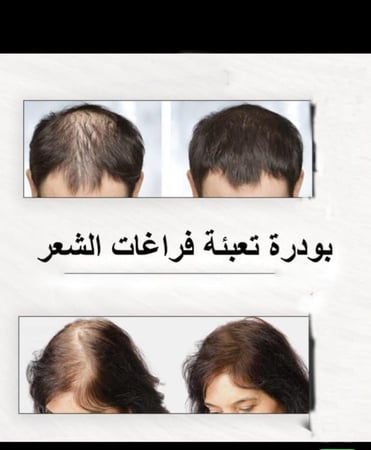 بودره إخفاء فراغات الشعر 22 غرام اسود
