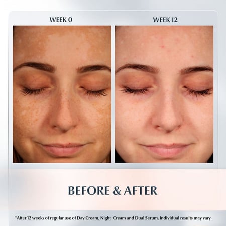 كريم يوسيرين للتصبغات