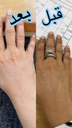 صابونية الاعشاب للتفتيح والنضارة